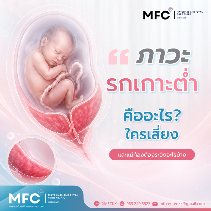 ภาวะรกเกาะต่ำ คืออะไร? ใครเสี่ยง และแม่ท้องต้องระวังอะไรบ้าง