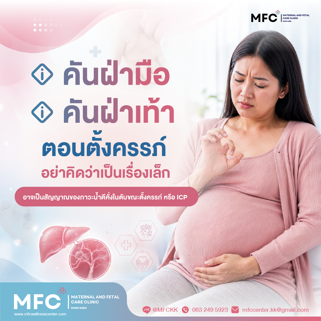 คุณแม่ตั้งครรภ์มีอาการคันฝ่ามือ ประกอบบทความเรื่องภาวะน้ำดีคั่งในตับขณะตั้งครรภ์